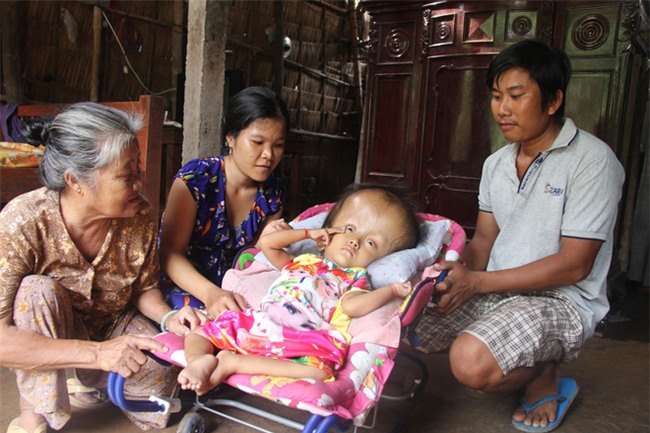 Phép màu kỳ diệu đến với cặp vợ chồng trẻ nuôi con gái 4 tuổi bị não úng thủy, đầu to gấp 3 lần trong năm mới - Ảnh 12.