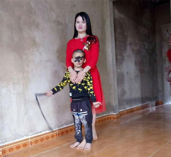 Cái Tết trọn vẹn đầu tiên của cậu bé 6 tuổi có khuôn mặt tựa người rừng tại Yên Bái - Ảnh 1.