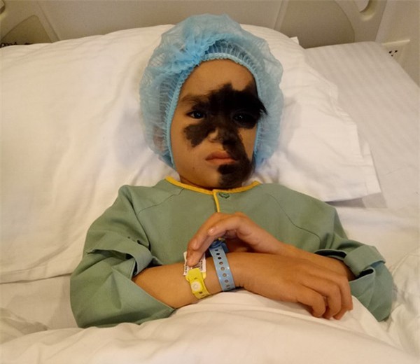 Cái Tết trọn vẹn đầu tiên của cậu bé 6 tuổi có khuôn mặt tựa người rừng tại Yên Bái - Ảnh 3.