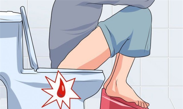 Chuyên gia cảnh báo dấu hiệu chảy máu bất thường trên cơ thể-2