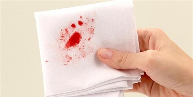 Chuyên gia cảnh báo dấu hiệu chảy máu bất thường trên cơ thể-3