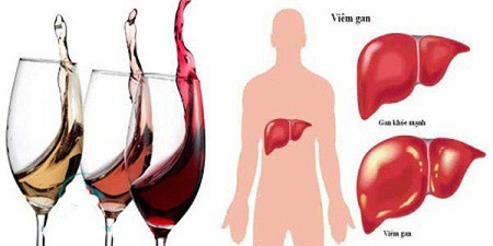 Cách giúp gan hồi phục hiệu quả vì uống nhiều rượu-2
