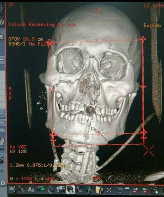 Người đàn ông bị nghi bắt cóc nữ sinh bán bóng được minh oan nhưng vẫn nhận được hàng loạt tin nhắn đe dọa