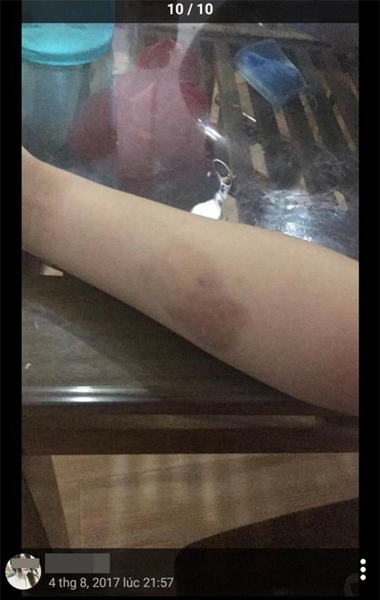 Vụ cắm sừng gây sốt nhất hôm nay: Hot girl yêu 3 năm cắm sừng bạn trai 7 lần, chửa 5 tháng vẫn ngủ với trai lạ - Ảnh 6.