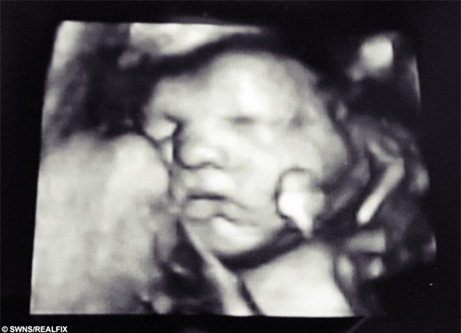 Vừa nghe cái tên phụ huynh định đặt cho mình, thai nhi trong bụng mẹ lập tức ra hiệu để bày tỏ quan điểm - Ảnh 1.