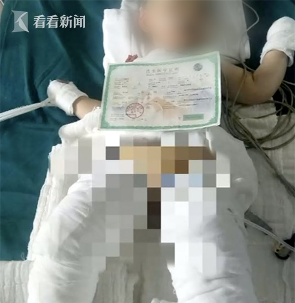 Thấy em sợ tiếng pháo, anh họ bế vào nhà không may vấp phải bình nước sôi, khiến em toàn thân bỏng nặng - Ảnh 3.