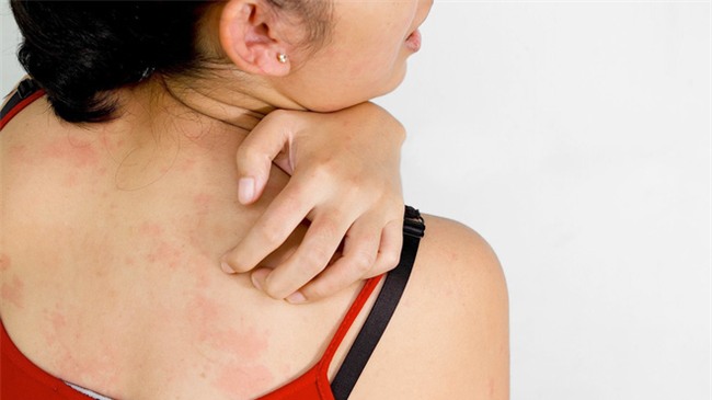 Trong thời tiết như hiện nay nhất định phải cẩn thận với quần áo ẩm kẻo rước hoạ vào thân - Ảnh 2.