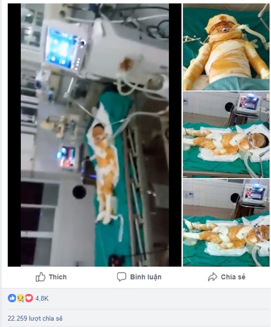 Thái Bình: Chập điện cháy nhà giữa đêm, vợ chồng bỏng nặng, bé gái 4 tuổi nguy kịch