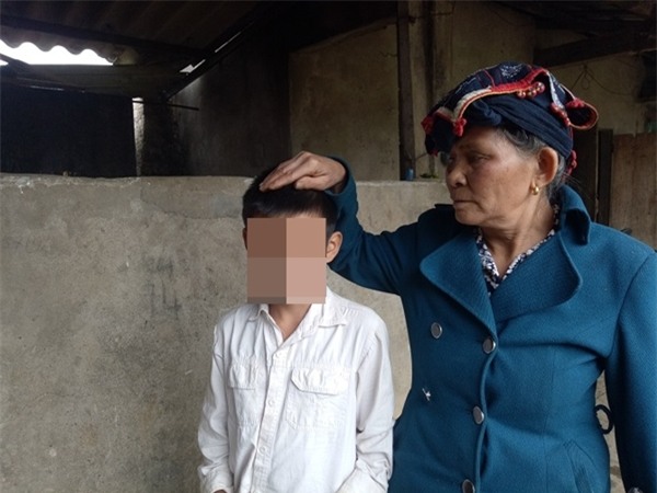 Sơn La:Trẻ 12 tuổi bị đánh đòn bầm dập vì nghi trộm 500 nghìn đồng