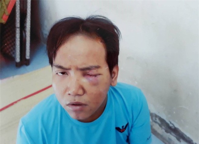 Vụ bảo vệ tổ dân phố sát hại bé trai 6 tuổi ở Sài Gòn: Kẻ gây án bị tâm thần phân liệt thể hoang tưởng - Ảnh 1.