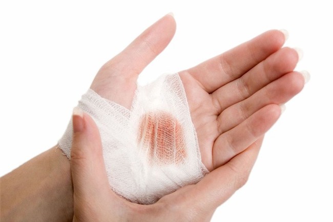 Clip bé trai sủa nghi do chó dại cắn, bác sĩ lên tiếng: Không có chuyện khi phát bệnh dại, bệnh nhân sủa như vật nuôi - Ảnh 6.