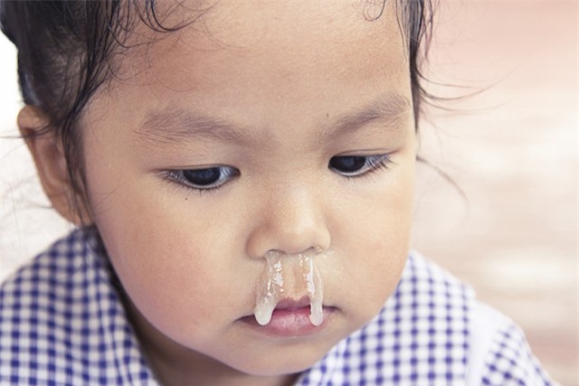 Các bác sĩ cảnh báo về cách chữa sổ mũi bằng tỏi ngâm nước muối sinh lý đang được các mẹ lan truyền - Ảnh 2.