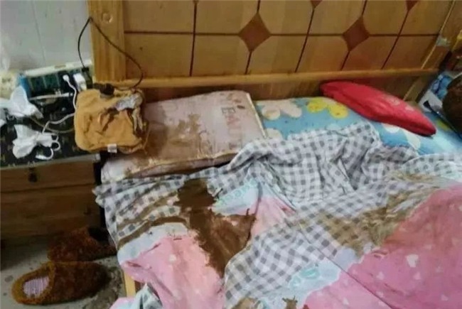 Gối sưởi phát nổ trong đêm, nam ca sĩ có nguy cơ bị hủy hoại sự nghiệp sau khi mặt bị bỏng nghiêm trọng - Ảnh 3.