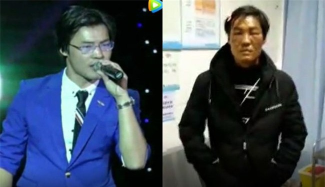 Gối sưởi phát nổ trong đêm, nam ca sĩ có nguy cơ bị hủy hoại sự nghiệp sau khi mặt bị bỏng nghiêm trọng - Ảnh 5.