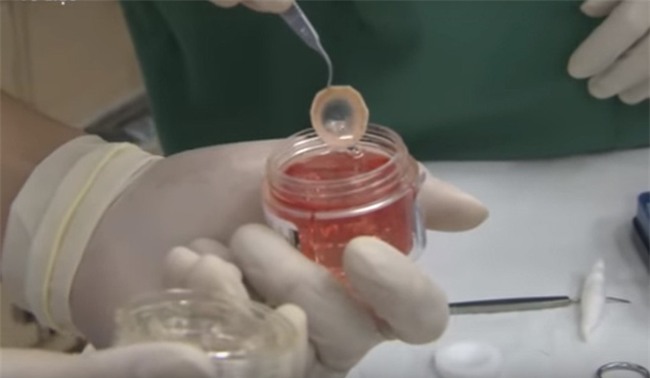 13 năm sống trong bóng tối bà lão 73 tuổi rớt nước mắt khi cuối đời lại được nhìn thấy con cháu