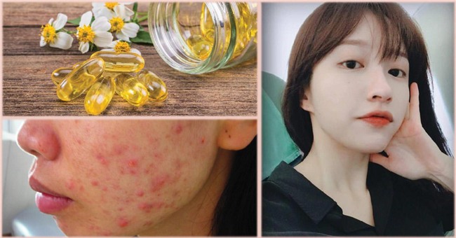 boi vitamin e len mat de duong da, chi em nhan duoc ket qua hon ca mong doi! - 5