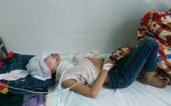 Tưới xăng thiêu sống con, cháu ruột vì nhuộm tóc đỏ - Ảnh 1.