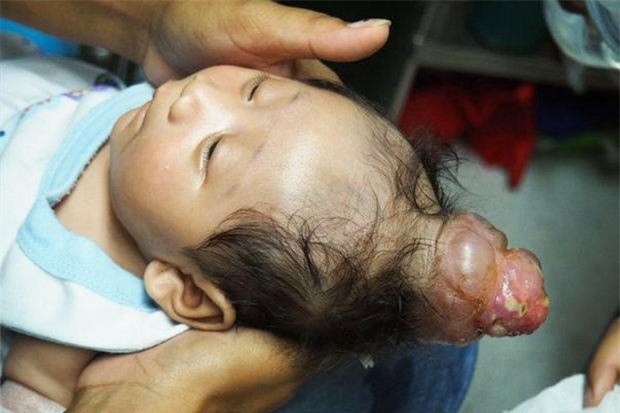 ky la be trai sinh ra da co "chiec sung" moc o giua dinh dau - 1