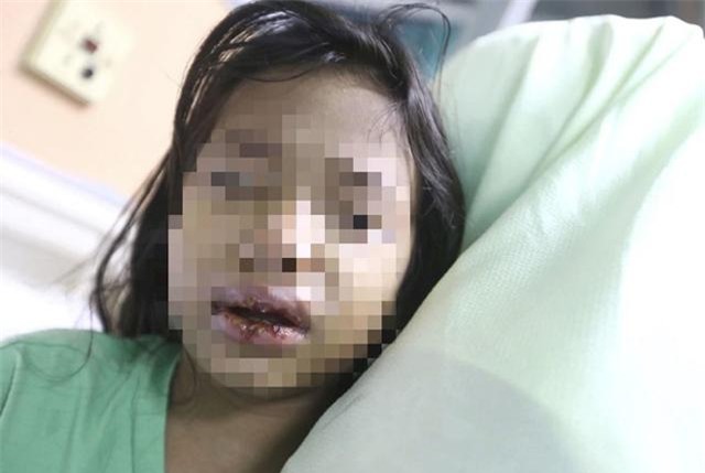 don con o nha chong cu, me soc nang phat hien con bi me ke danh, ep uong nuoc soi - 2