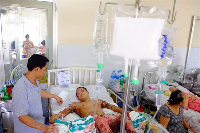 Thương cha không đủ sức khỏe, cậu bé 16 tuổi hai lần lóc da cứu anh ruột bị lửa dầu thiêu sống - Ảnh 1.