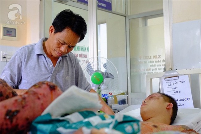 Thương cha không đủ sức khỏe, cậu bé 16 tuổi hai lần lóc da cứu anh ruột bị lửa dầu thiêu sống - Ảnh 8.