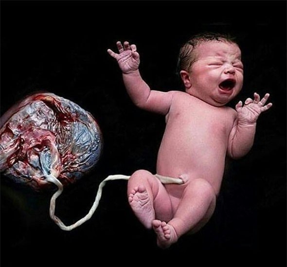 Mẹ bầu ở Hưng Yên gây sốc khi sinh con tại nhà, tự đỡ đẻ và để nhau thai gắn với bé đến 6 ngày sau sinh