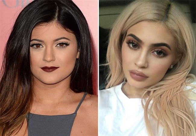 tiem filler lam day moi va nhung dang moi hot nhat nam 2018 cac nang can cap nhat - 1