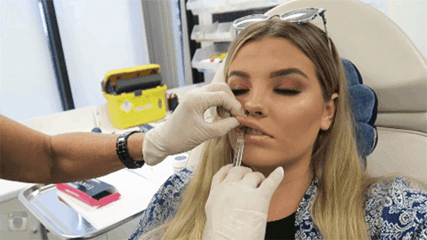 tiem filler lam day moi va nhung dang moi hot nhat nam 2018 cac nang can cap nhat - 11