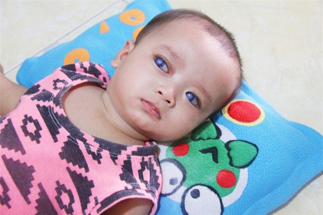 Xót cảnh người mẹ đi tìm ánh sáng cho đứa con trai mù 6 tháng tuổi, để em gái 12 tuổi nghỉ học vì nợ nần - Ảnh 2.