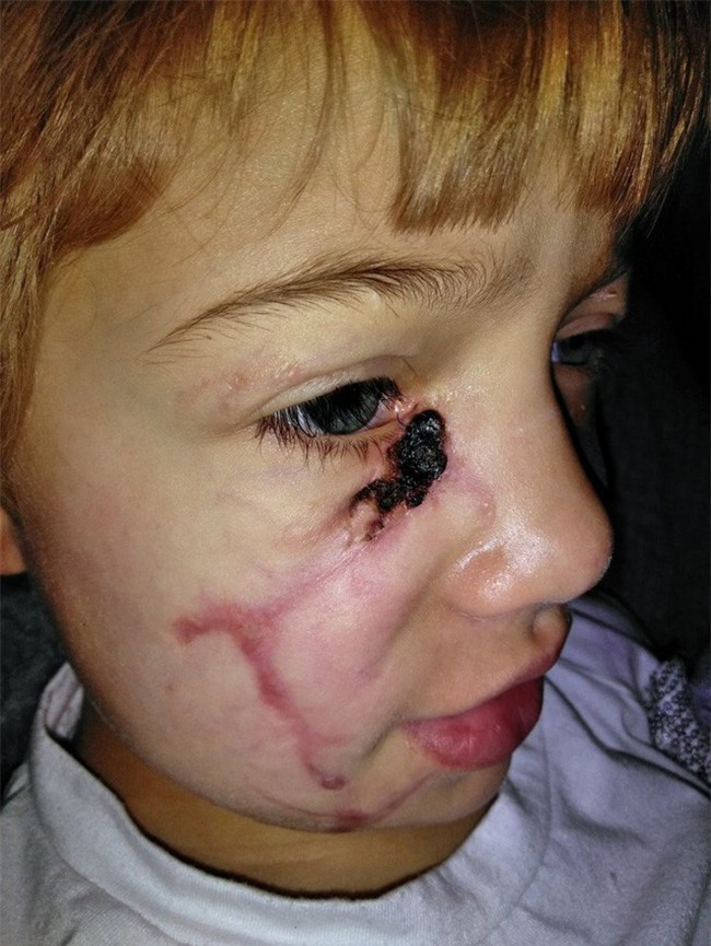 Bị chó cắn đến rách mặt, cô bé 6 tuổi mỗi ngày đều chụp ảnh selfie để học cách chấp nhận diện mạo mới của mình - Ảnh 5.