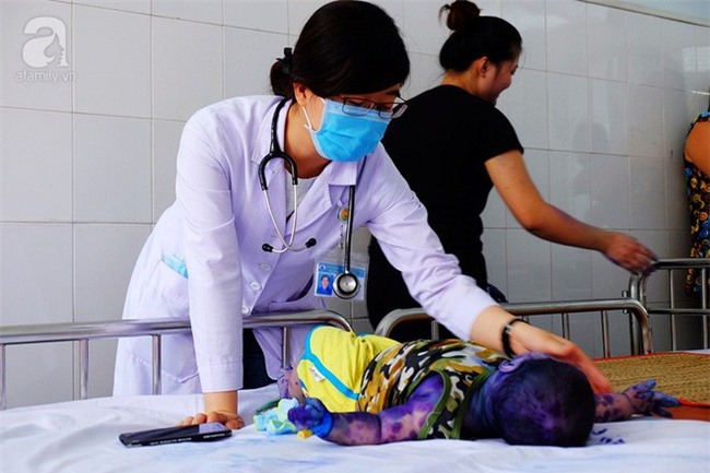 Mẹ không chích ngừa trước sinh, hàng loạt trẻ dưới 3 tháng tuổi mắc bệnh thủy đậu nhập viện tại TP.HCM