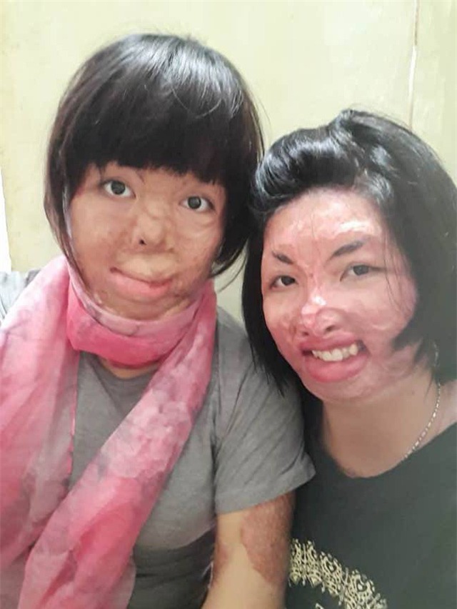 2 người phụ nữ bị chồng tẩm xăng đốt nắm tay nhau tô hồng cuộc sống