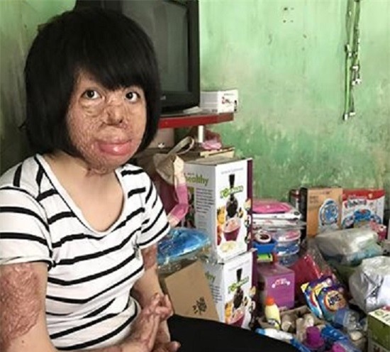 2 người phụ nữ bị chồng tẩm xăng đốt nắm tay nhau tô hồng cuộc sống