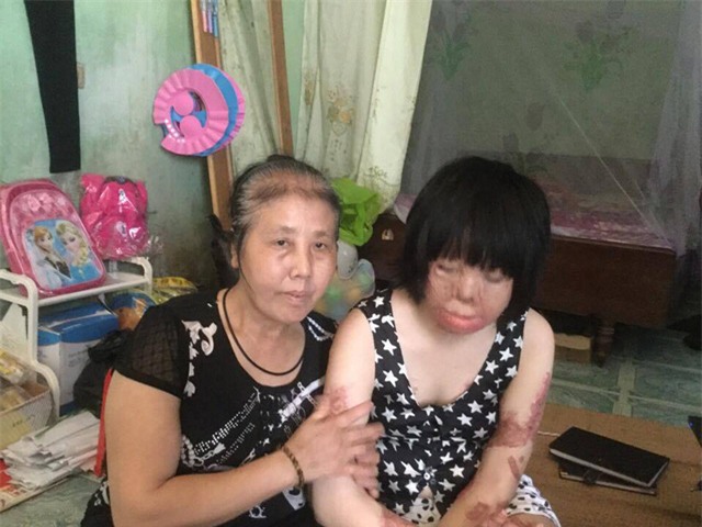 2 người phụ nữ bị chồng tẩm xăng đốt nắm tay nhau tô hồng cuộc sống