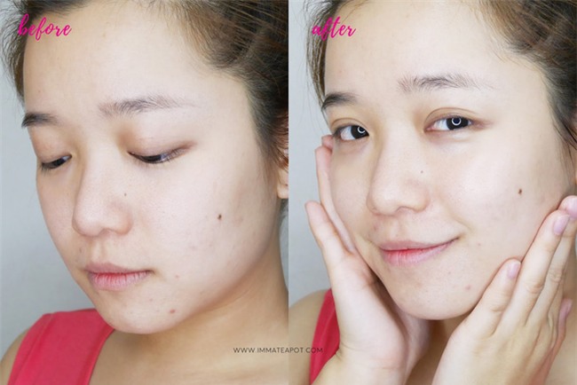 6 loại mặt nạ dưỡng ẩm sâu giá từ 40.000VNĐ mà các bác sĩ da liễu uy tín sử dụng - Ảnh 4.