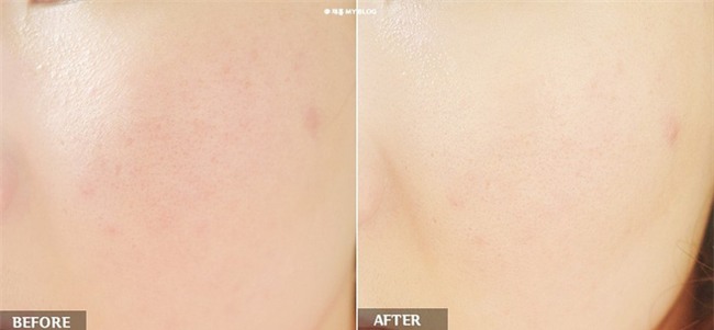 6 loại mặt nạ dưỡng ẩm sâu giá từ 40.000VNĐ mà các bác sĩ da liễu uy tín sử dụng - Ảnh 9.