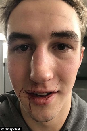 Mỹ: Cô gái xinh đẹp đấm vỡ mũi bạn trai dám chia tay