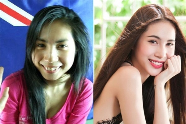 Khi mới gia nhập làng giải trí, ca sĩ&nbsp;Thủy Tiên&nbsp;có hàm răng không đều và có phần xỉn màu. Sau đó, cô đã quyết định chỉnh sửa lại hàm răng của mình để có được nụ cười hoàn hảo và đầy quyến rũ như hiện nay. - Tin sao Viet - Tin tuc sao Viet - Scandal sao Viet - Tin tuc cua Sao - Tin cua Sao