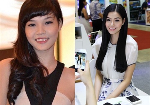 Kỳ Hân là một trong những người đẹp dũng cảm công khai mình phẫu thuật thẩm mỹ để có một diện mạo ưa nhìn. - Tin sao Viet - Tin tuc sao Viet - Scandal sao Viet - Tin tuc cua Sao - Tin cua Sao