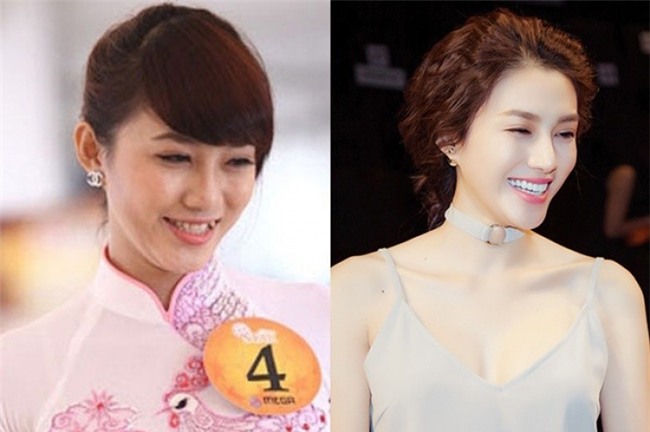 Lê Hà có sự thay đổi rõ rệt về nhan sắc nhờ làm răng sứ. - Tin sao Viet - Tin tuc sao Viet - Scandal sao Viet - Tin tuc cua Sao - Tin cua Sao