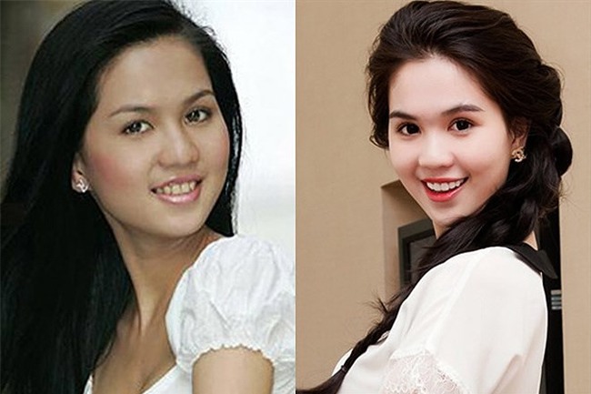 Ngọc Trinh cũng từng sở hữu hàm răng xỉn màu hồi mới vào nghề. Vẻ ngoài của cô thêm hoàn thiện sau khi chỉnh sửa răng. - Tin sao Viet - Tin tuc sao Viet - Scandal sao Viet - Tin tuc cua Sao - Tin cua Sao