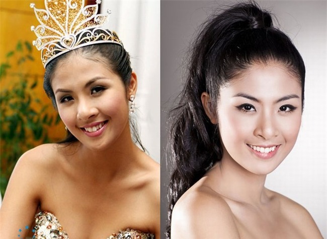 Hàm răng khấp khểnh từng gây 