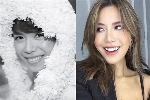 Siêu mẫu Minh Tú cũng sở hữu nụ cười tươi hơn sau khi chỉnh răng. - Tin sao Viet - Tin tuc sao Viet - Scandal sao Viet - Tin tuc cua Sao - Tin cua Sao