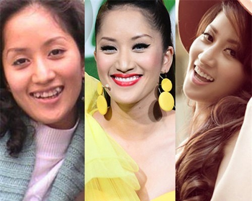 Khi mới vào nghề, Khánh Thi không có gì nổi bật khi sở hữu một nhan sắc bình thường cùng hàm&nbsp;răng mọc lệch lạc.&nbsp;Cô luôn mặc cảm với điều ấy, chính vì vậy Khánh Thi đã quyết định chỉnh sửa răng.&nbsp;Thật bất ngờ với kết quả trước và sau khi niềng răng của 