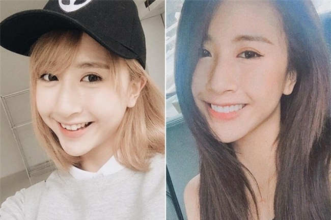 Quỳnh Anh Shyn khác hẳn&nbsp;với hàm răng mới. - Tin sao Viet - Tin tuc sao Viet - Scandal sao Viet - Tin tuc cua Sao - Tin cua Sao