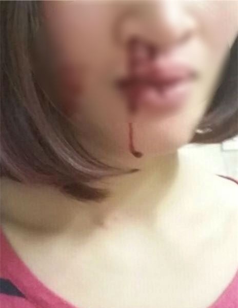 Vừa sảy thai 1 tuần, người vợ này chẳng những không được an ủi mà còn bị chồng tát bật máu trước mặt con nhỏ - Ảnh 2.