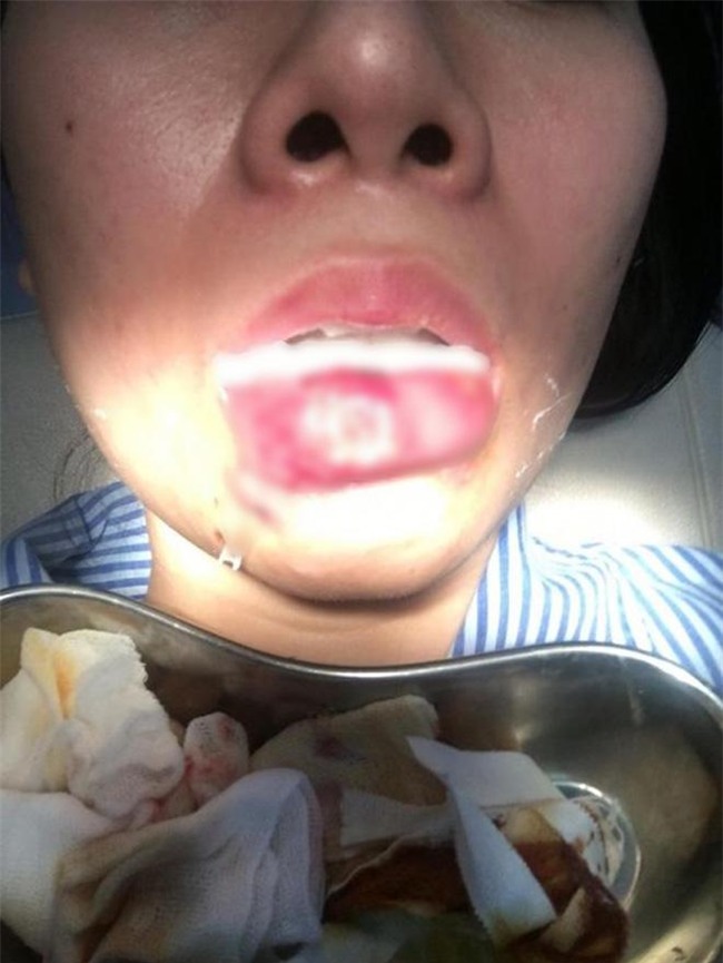 1001 tham hoa "lon lanh hoa que" khien chi em phai suy nghi ki truoc khi bom moi! - 1