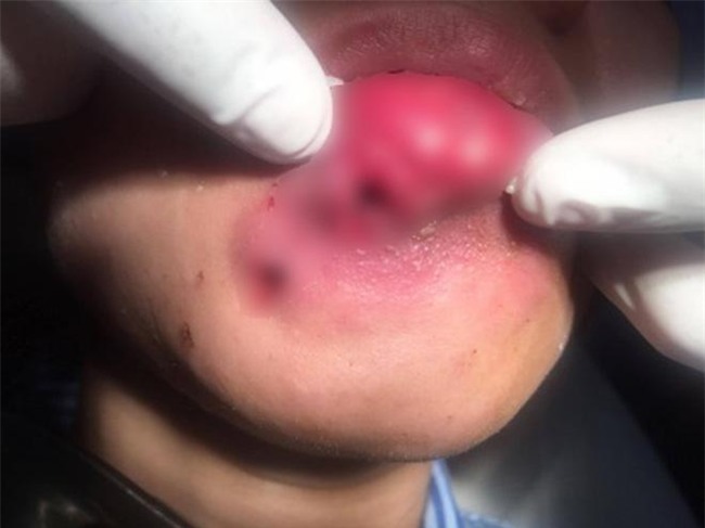 1001 tham hoa "lon lanh hoa que" khien chi em phai suy nghi ki truoc khi bom moi! - 2