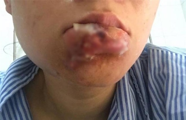 1001 tham hoa "lon lanh hoa que" khien chi em phai suy nghi ki truoc khi bom moi! - 3