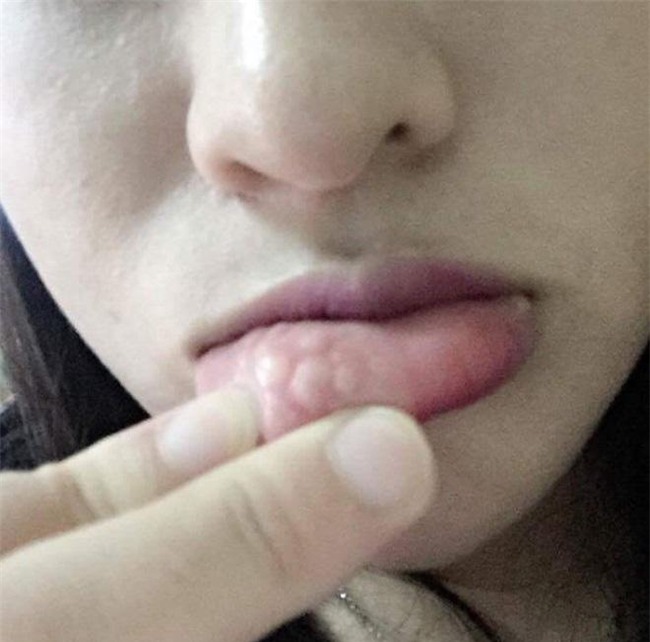 1001 tham hoa "lon lanh hoa que" khien chi em phai suy nghi ki truoc khi bom moi! - 4